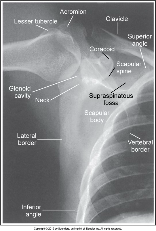 <p>AP scapula</p>