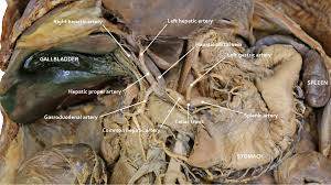 <p>blueish green sack below liver</p><ul><li><p>structure</p></li></ul><p></p>