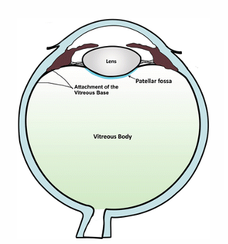 <p>the indentation of the vitreous face where the lens sits</p>