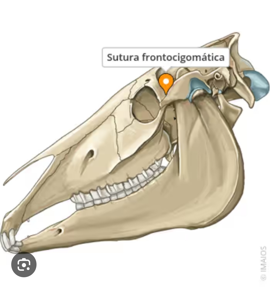 <p>sutura frontocigomatica </p>