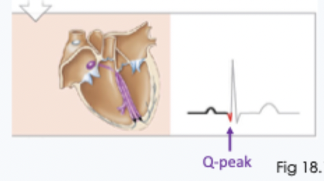 <p>what creates the start of the QRS (as on image)</p>