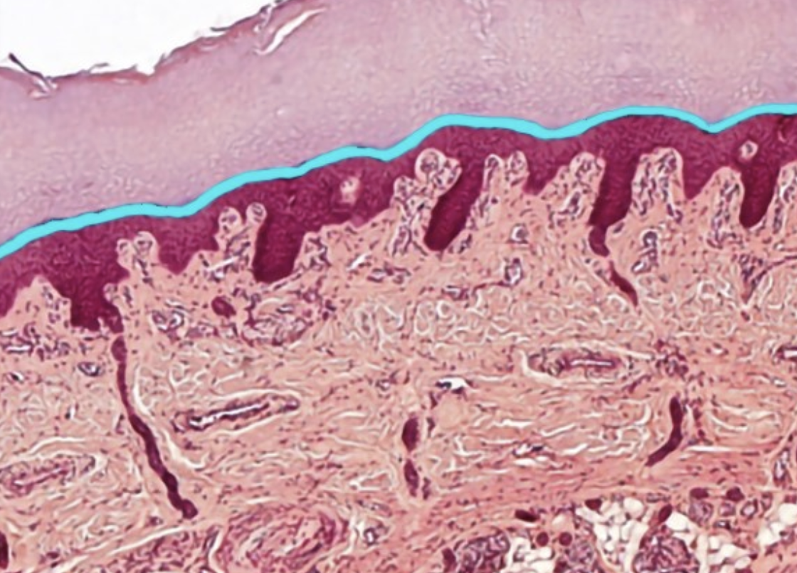 term image