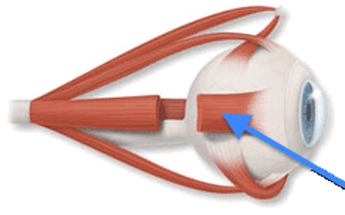 <p>Skull Opening:</p><p>Superior orbital fissure</p><p>Muscle Group: </p><p>Extraocular</p><p>Key Muscles:</p><p>Lateral rectus</p><p>Main Function:</p><p>Abducts eye</p><p>Clinical Correlation:</p><p>Increase ICP trauma</p><p>Classic Symptoms:</p><p>Medial deviation</p>