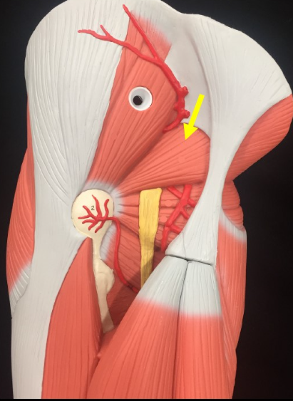 <p>Name the muscle</p>