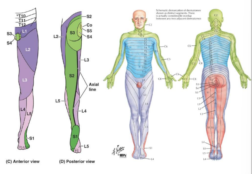 <p>L1: groin region near inguinal ligament</p><p>L2: superior-anterior thigh to lateral thigh </p><p>L3: distal anterior thigh to medial thigh</p><p>L4: medial lower leg</p><p>L5: lateral lower leg</p><p>S1: lateral foot/posterior medial thigh</p><p>S2: posterior lower leg/posterior medial thigh</p>