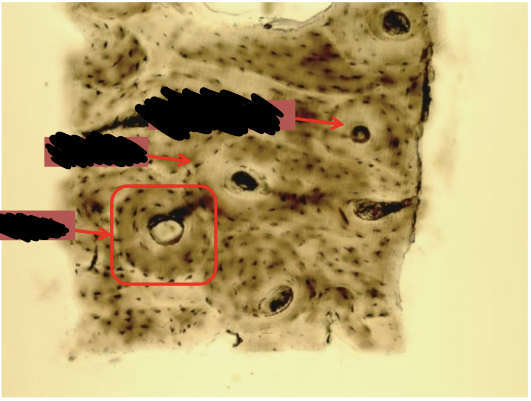 <p>What type of connective tissue is this?</p>
