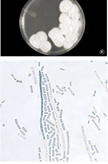 <p>ID this yeast like fungus </p>