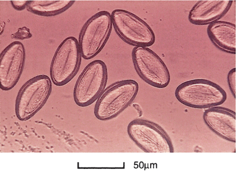 <p>What is this parasite (genus and species)?</p>