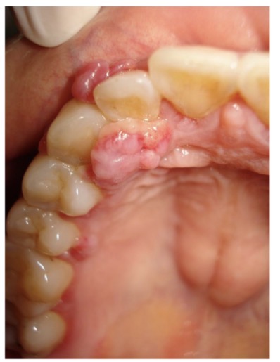 <p>CHẨN ĐOÁN?</p>