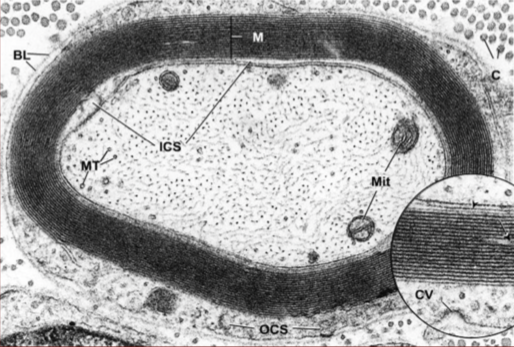 <p>What is that dark layered rings around this fiber?</p>