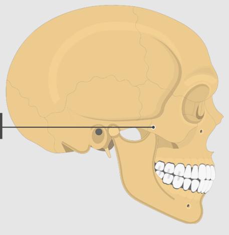 <p>Projection of zygomatic bone</p>