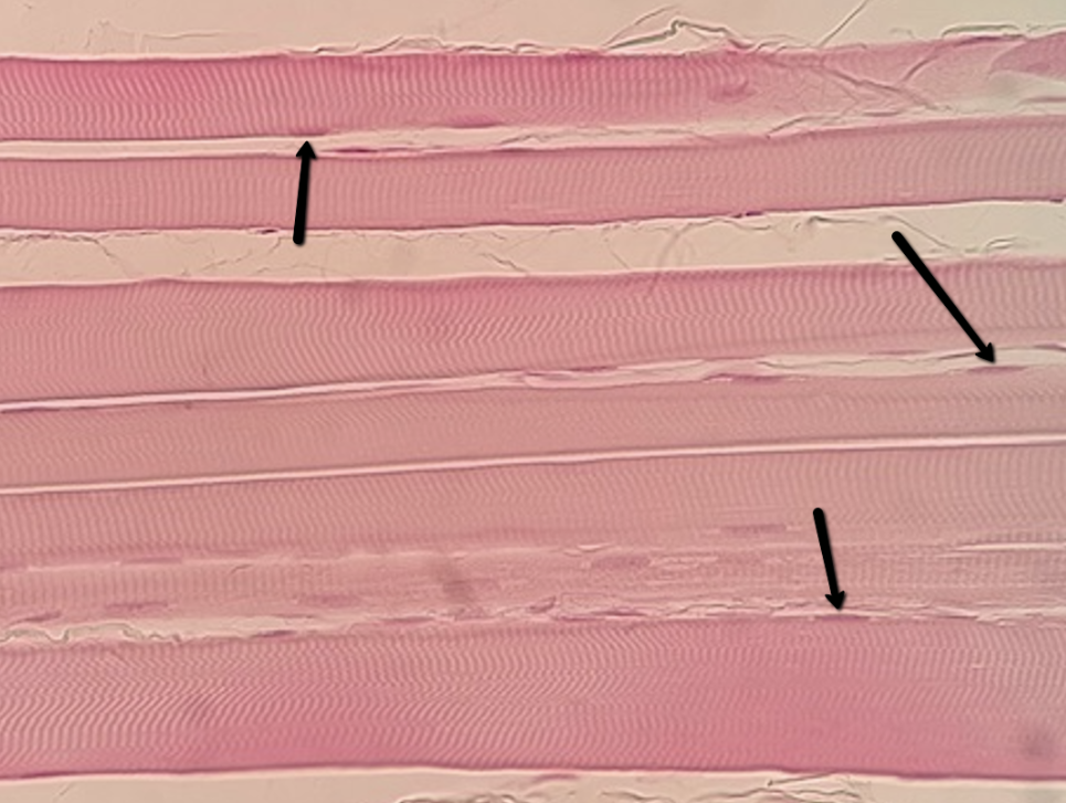 <p><span>Identify the small dark structures indicated by the arrows.</span></p>