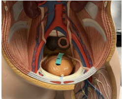 <p>what type of tissue lines this organ labeled here? </p>