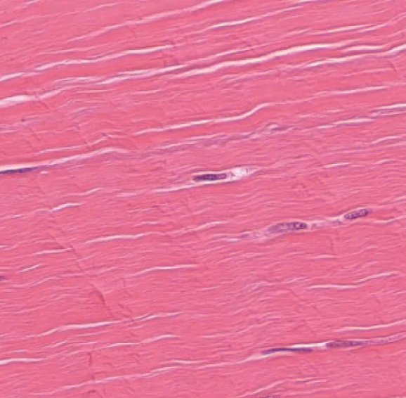<p>what type of tissue is this? </p>