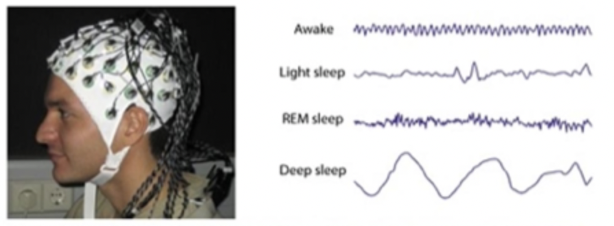 <p>What does EEG measure?</p>