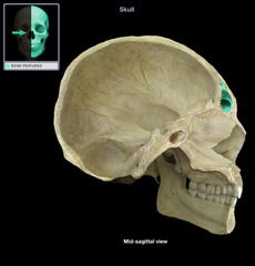 <p>located in the frontal bone just above the eyebrows</p>