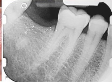 <p>CHẨN ĐOÁN</p>