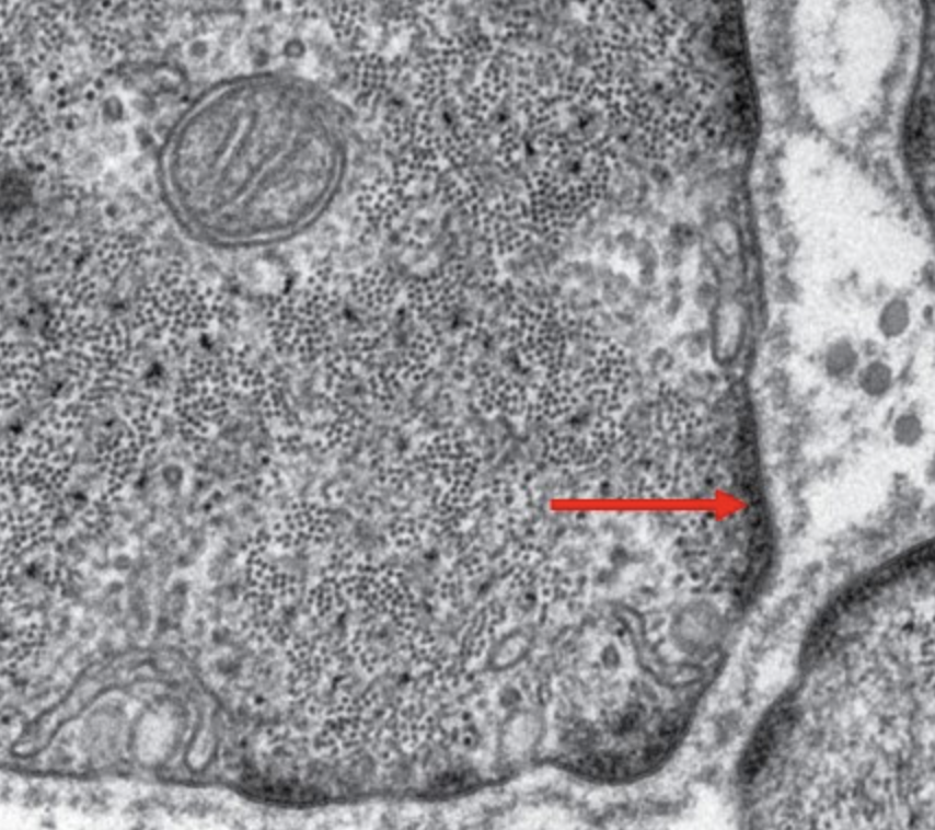 <p>identify the structure indicated by the pointer</p>