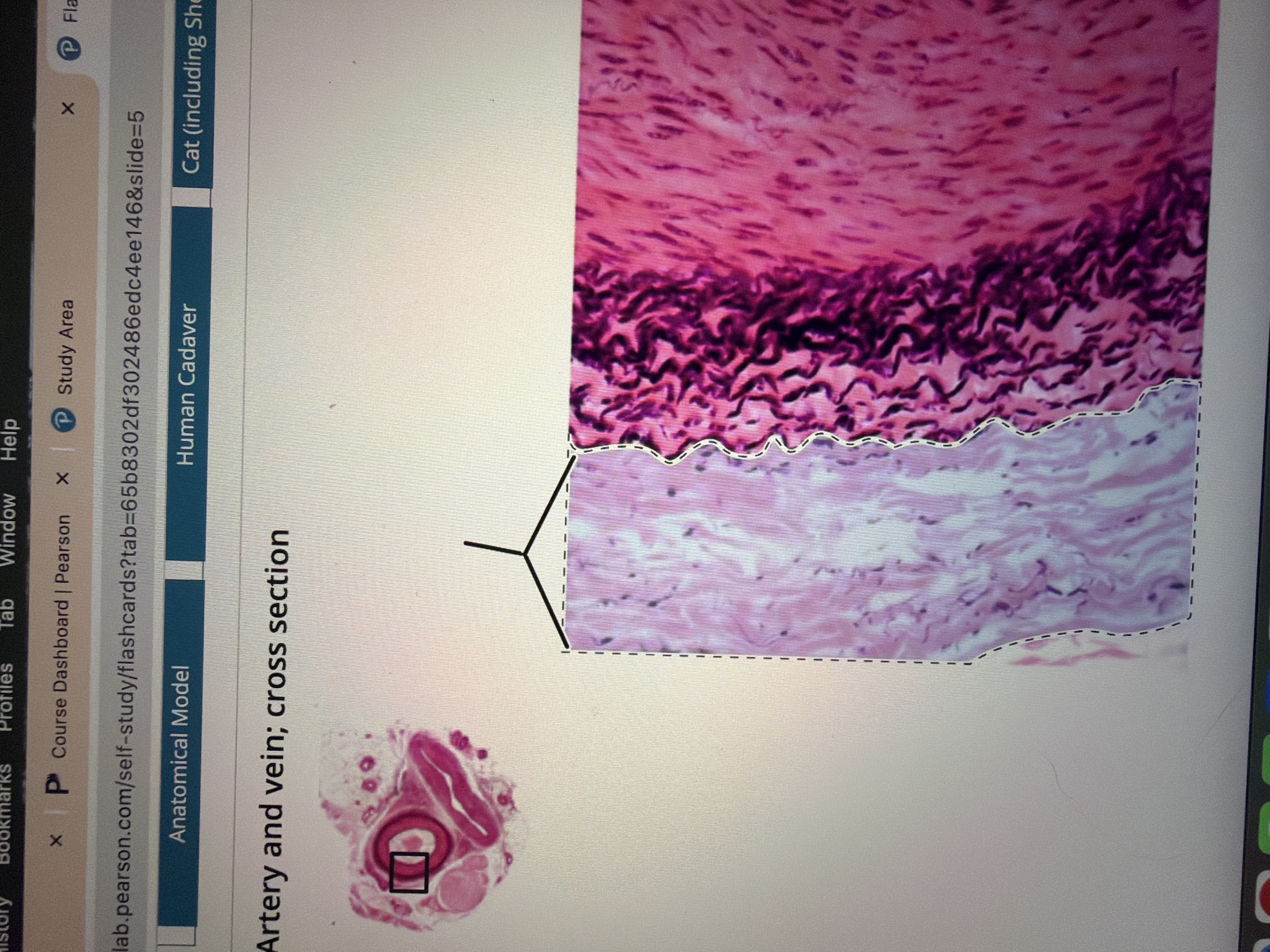 <p>Artery</p>