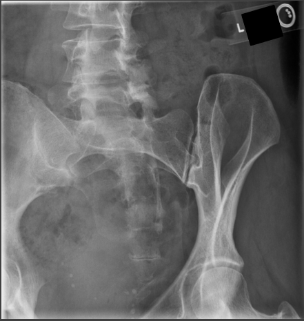 <p>critique for SI obliques </p>