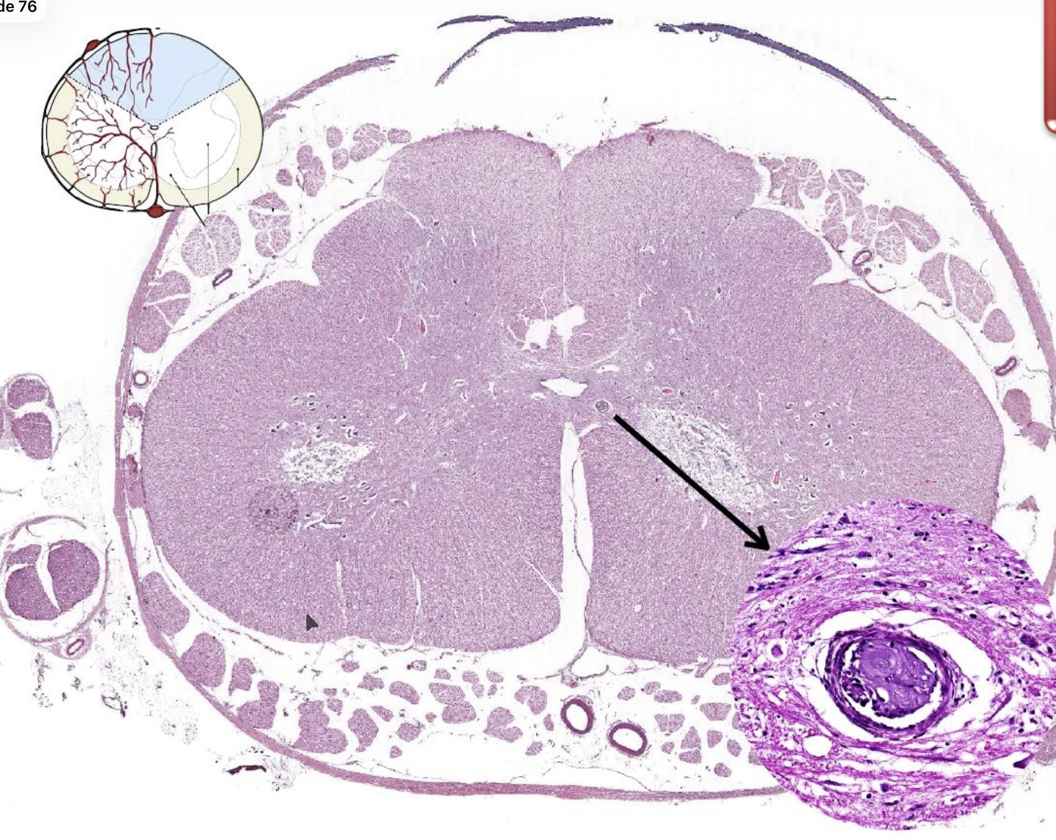 <p>Patogenia</p>