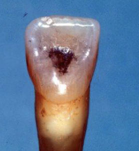 <p>To have a strategically designed cavity prep designed to provide straight-line access to root canals</p>