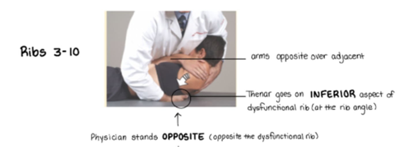 <p>pt supine, arms opposite over adjacent</p><p>stand on OPPOSITE side of dysfunctional rib</p><p>thenar eminence on ___ angle of rib angle to push rib back</p><ul><li><p><strong><u>inferior</u></strong> aspect of rib angle for <u>exhalation sd</u> → ribs stuck down</p></li><li><p><strong><u>superior</u></strong> aspect of rib angle for <u>inhalation sd</u> → ribs stuck up</p></li></ul><p>(basically thoracic HVLA other than hand placement)</p>