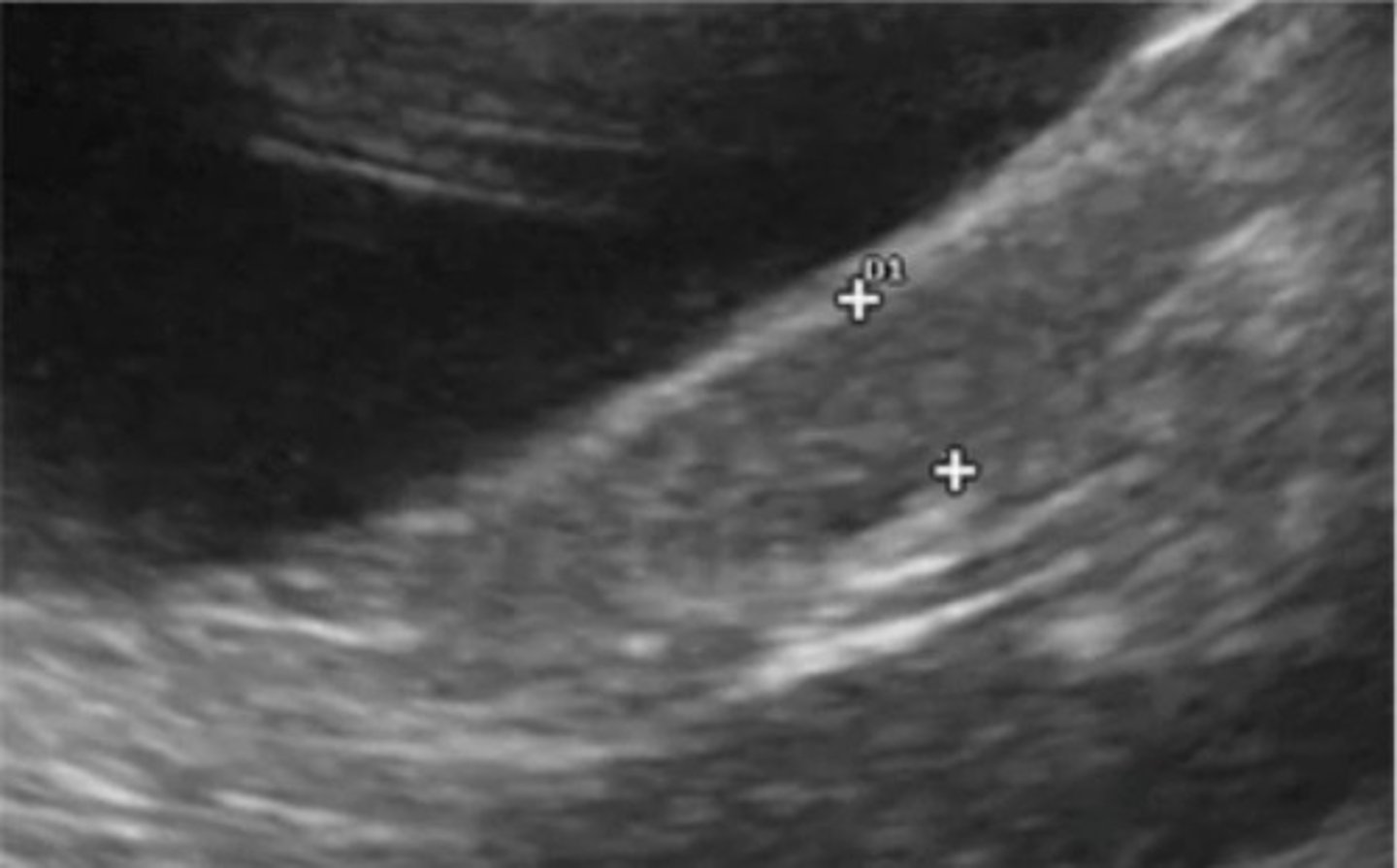 <p>uterus</p>