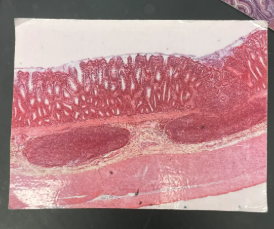 <p>Mucosa</p><ul><li><p>Simple columnar epithelium & tons of goblet cells</p></li><li><p>Intestinal glands</p></li></ul><p>Submucosa</p><p>Muscularis: Smooth muscle (2 layers)</p><p>Serosa</p>