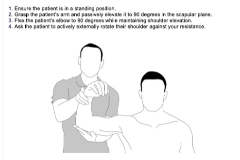 <p>Teken posterieur cuff schade (vnl. teres minor)</p>