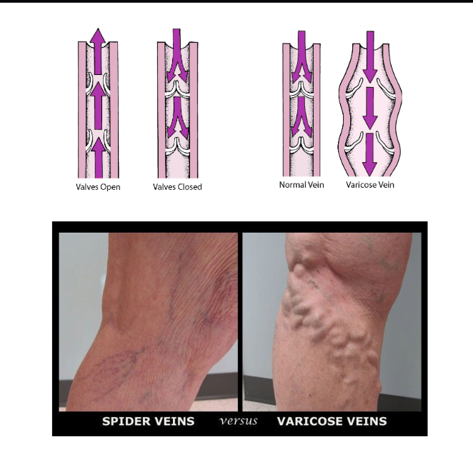 <p>What structure do many veins have?<br></p>
