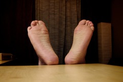 <p>Sole of the foot</p>