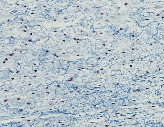 <p><span style="font-family: "Calibri Light";">1. Which basic type of CT is this?<br><br>2. Can you be more specific?<br><br>3. What is another name for this CT?</span></p>