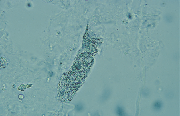 term image