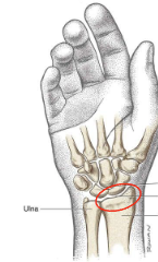 <p>What is this joint?</p>