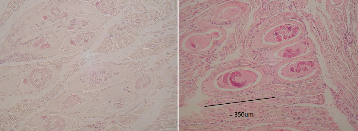 <p>What is this parasite </p>