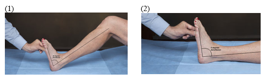 <p>Your patient is lying on a table with her knee flexed. She maximally dorsiflexes her ankle and is able to dorsiflex her ankle 20 degrees (#1 in picture below). She then extends her knee and again maximally dorsiflexes her ankle. This time she is only able to dorsiflex her ankle 5 degrees (#2 in picture below). What is causing this change in available ROM:</p>