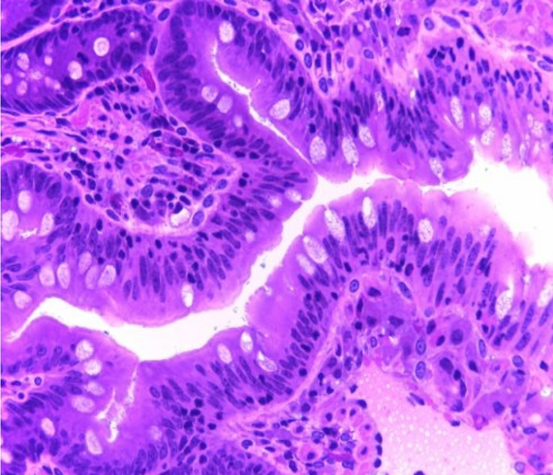 <p>Simple Columnar Epithelium</p>