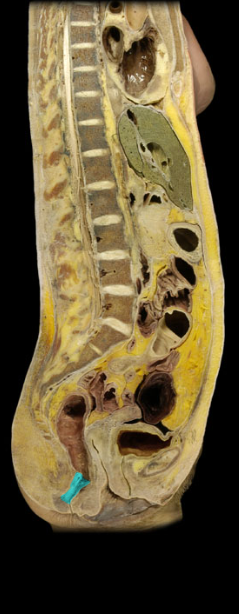 <p>last and shortest segment of large intestine, begins at the pelvic diaphragm and ends at the anus</p>