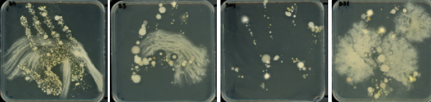 <p><strong>Skin bacteria</strong>: <span>possibly </span></p><p><span>Micrococcus luteus (small yellow colonies), </span></p><p><span>Staphylococcus epidermidis (small, thick white colonies),</span></p><p><span>Staphylococcus aureus (golden colonies)</span></p><p><span><strong>Fungus</strong>:</span></p><p><span>Fluffy structure</span></p><p><span>(colonies differ in shape, size, colour)</span></p>