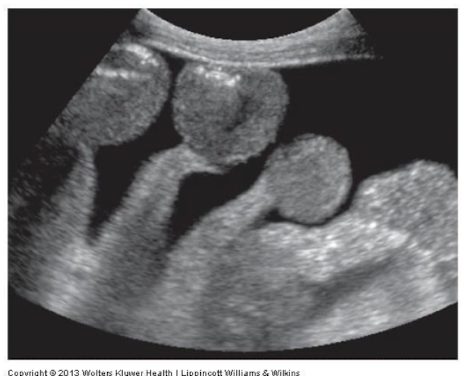 <p>This is an image of:</p>