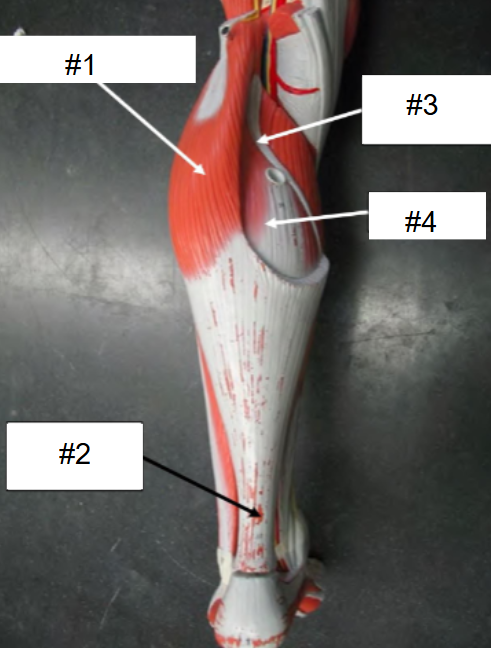<p>What is #2? (Calf, posterior view, superficial muscles removed)</p>