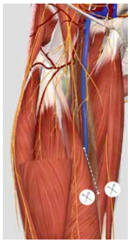 <p>Diep, anterior zicht → Membraan </p>