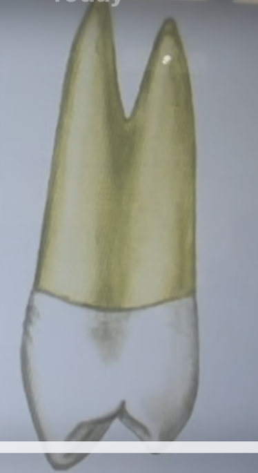 <p>Maxillary right first premolar, maxillary right second premolar, mandibular right first premolar, mandibular right second premolar</p>