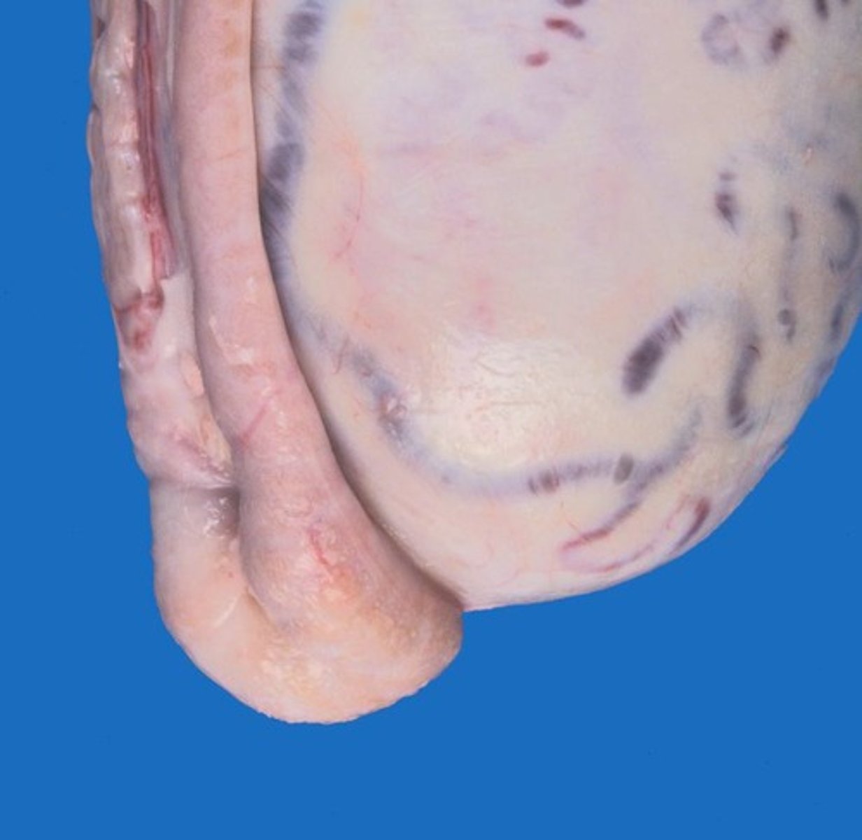 <p>Storage, concentration, and maturation of spermatozoa.</p>