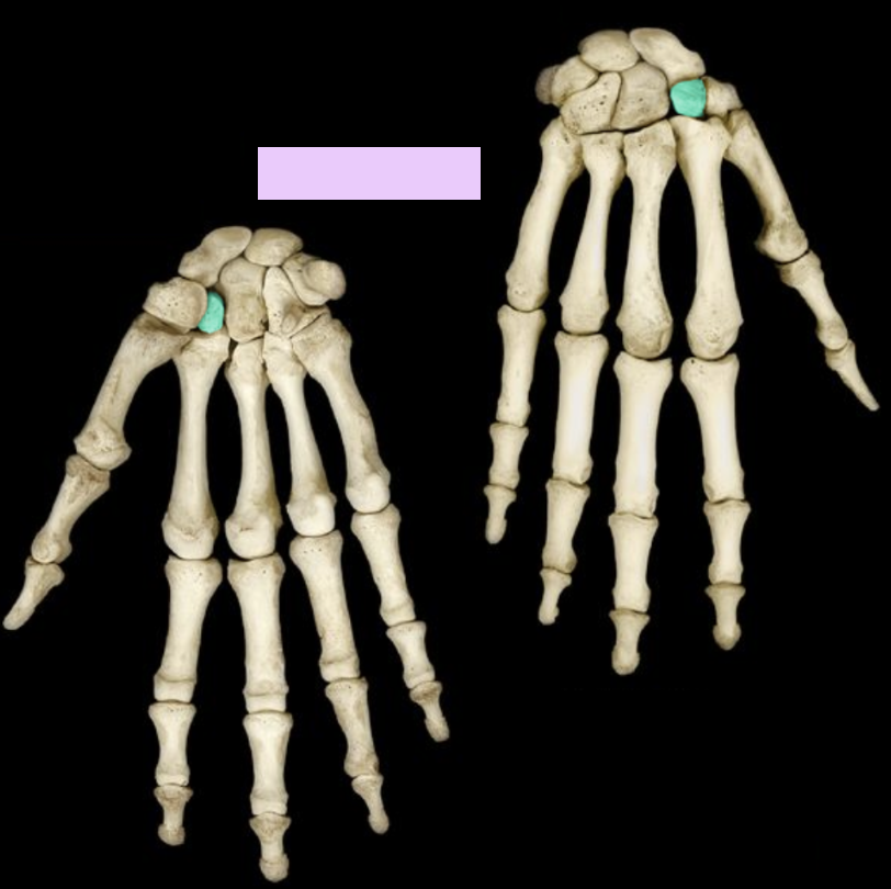 <p>What structure is highlighted?</p>