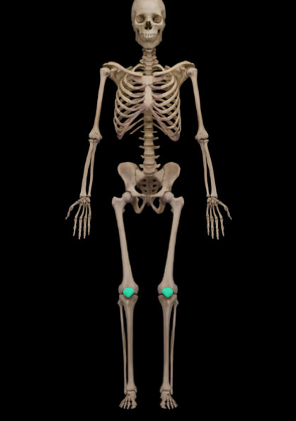 <p>What is the name of this bone?</p>