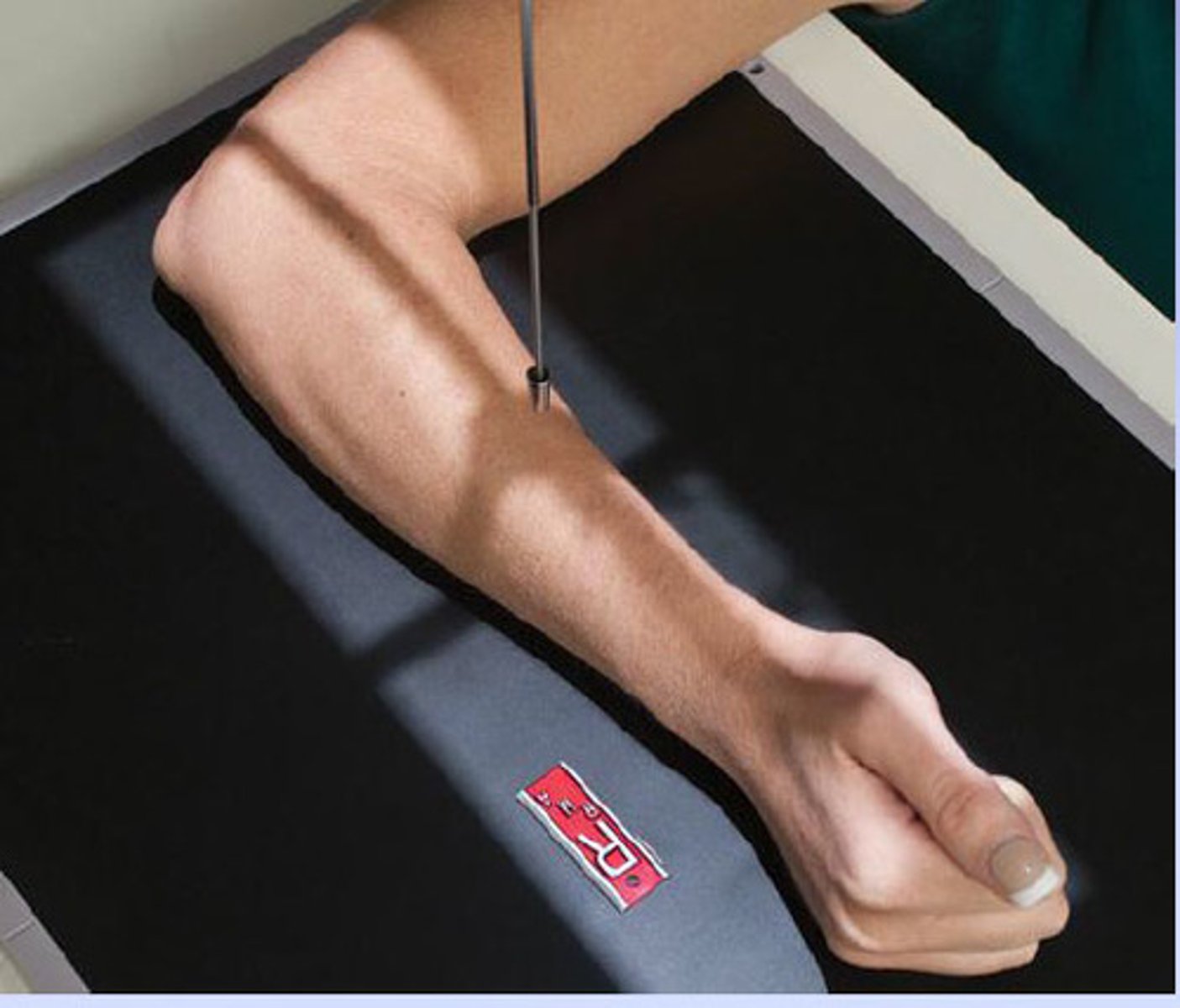 <p>S - around waist</p><p>T - 6 mAs @ 66 kVp</p><p>A - none</p><p>M - correct marker on cassette</p><p>P - CR midforearm, epicondyles perp</p><p>S - 40</p><p>B - suspension</p><p>C - 14 x 17</p>