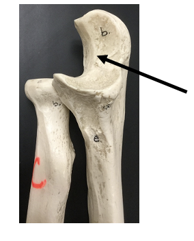 <p>What bone and bone feature is this?</p>
