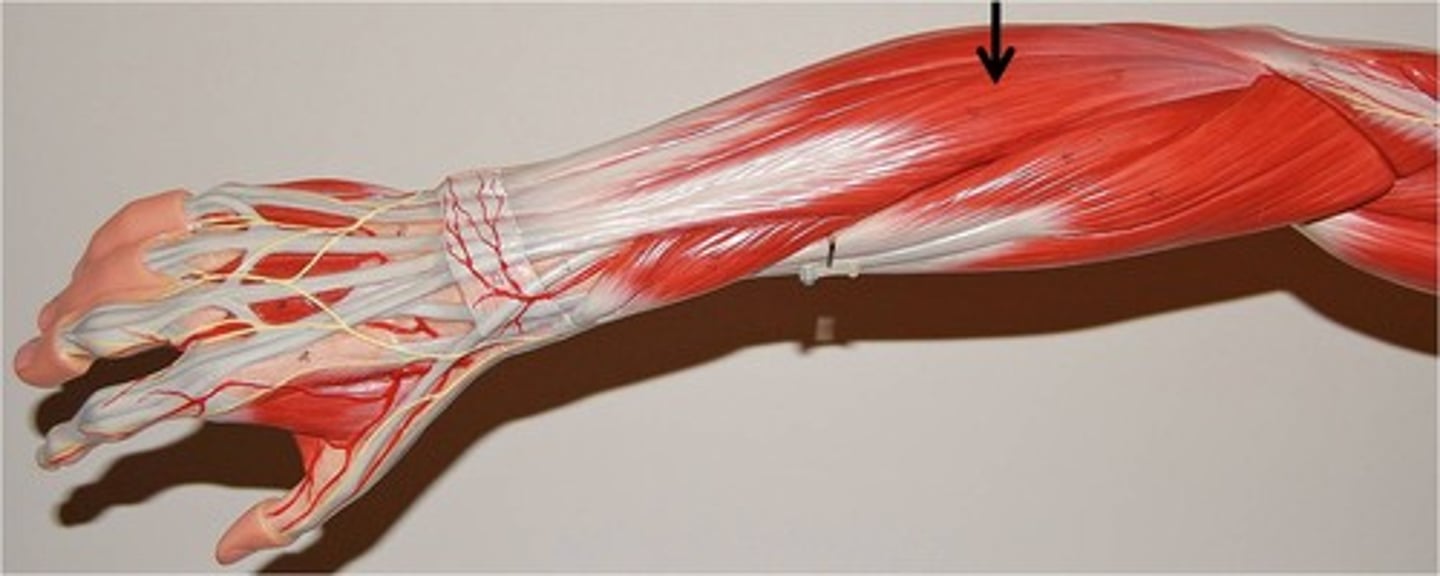 <p>Extensor Digitorum</p>